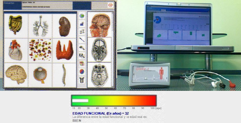 analisis